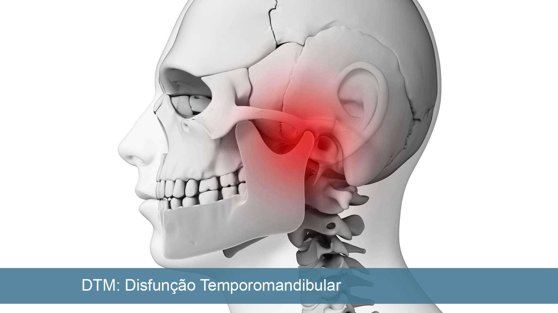 Distúrbios temporomandibulares - Distúrbios da boca e dos dentes - Manual  MSD Versão Saúde para a Família